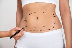 Your Path to a Toned Midriff Starts with Abdominoplasty in Miami post thumbnail image